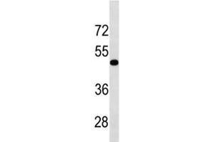 TGFBR1 antibody western blot analysis in human HL-60 lysate. (TGFBR1 Antikörper  (AA 145-172))