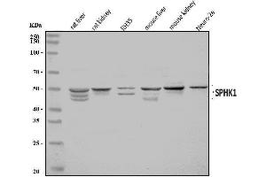 Western blot analysis of SPHK1 using anti-SPHK1 antibody (ABIN7600168). (SPHK1 Antikörper  (AA 16-267))