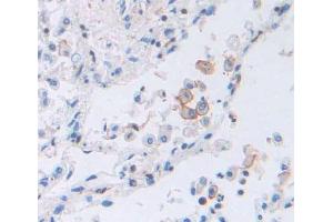Immunohistochemistry (IHC) image for anti-Transporter 2, ATP-Binding Cassette, Sub-Family B (MDR/TAP) (TAP2) (AA 468-686) antibody (ABIN5013138)