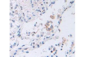Used in DAB staining on fromalin fixed paraffin- embedded lung tissue (TAP2 Antikörper  (AA 468-686))