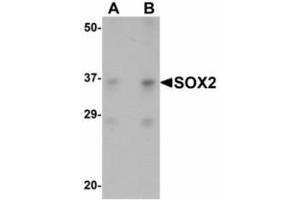 Image no. 1 for anti-SRY (Sex Determining Region Y)-Box 2 (SOX2) (N-Term) antibody (ABIN478109) (SOX2 Antikörper  (N-Term))