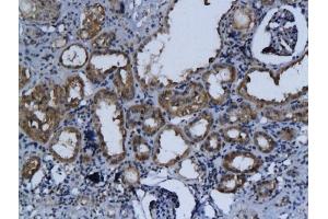 Formalin-fixed and paraffin embedded rat kidney labeled with Anti-Talin Polyclonal Antibody, Unconjugated (ABIN701695) followed by conjugation to the secondary antibody and DAB staining (TLN1 Antikörper  (AA 1601-1750))