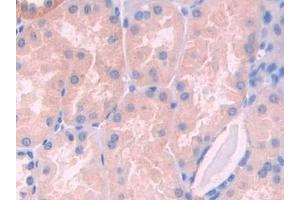 Detection of LCAT in Human Kidney Tissue using Polyclonal Antibody to Lecithin Cholesterol Acyltransferase (LCAT) (LCAT Antikörper  (AA 290-433))
