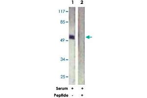 Western blot analysis of extracts from HeLa cells, treated with Serum (20 %, 15 mins), using ETS1 polyclonal antibody .