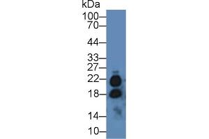 Western Blot; Sample: Mouse Testis lysate; Primary Ab: 2µg/mL Rabbit Anti-Human IL17 Antibody Second Ab: 0. (IL-17 Antikörper  (AA 20-155))