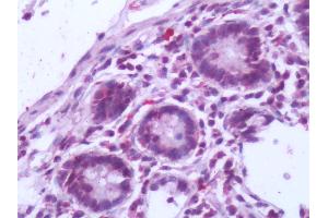 Immunohistochemistry (IHC) image for anti-Nuclear Receptor Subfamily 5, Group A, Member 2 (NR5A2) (Internal Region) antibody (ABIN213385)