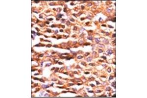 Image no. 2 for anti-Protein Phosphatase 2, Catalytic Subunit, alpha Isozyme (PPP2CA) (AA 1-30), (N-Term) antibody (ABIN360806) (PPP2CA Antikörper  (N-Term))