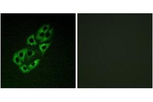 Immunofluorescence analysis of A549 cells, using MtSSB Antibody.