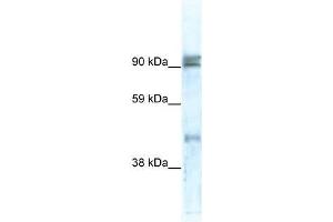 Western Blot showing ZNF227 antibody used at a concentration of 1-2 ug/ml to detect its target protein. (ZNF227 Antikörper  (N-Term))