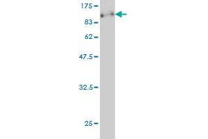 Western Blot detection against Immunogen (89. (CDKN2AIP Antikörper  (AA 1-579))