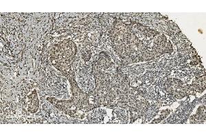 IHC analysis of U2AF65/U2AF2 using anti U2AF65/U2AF2 antibody (ABIN7600795).