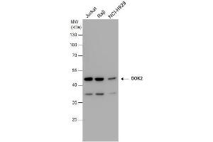 WB Image DOK2 antibody detects DOK2 protein by western blot analysis. (DOK2 Antikörper)