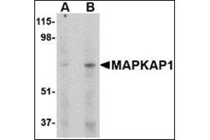 Western blot analysis of MAPKAP1 in human skeletal muscle tissue lysate with this product at (A) 1 and (B) 2 μg/ml.