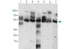 Western blot analysis of Lane 1: Hela cell lysate; Lane 2: K562 cell lysate; Lane 3: NIH/3T3 cell lysate; Lane 4: C6 cell lysate; Lane 5: MCF-7 cell lysate; Lane 6: Jurkat cell lysate; Lane 7: A431 cell lysate with CCNE1 monoclonal antibody, clone 5F8C5  at 1:500-1:2000 dilution. (Cyclin E1 Antikörper  (AA 307-410))
