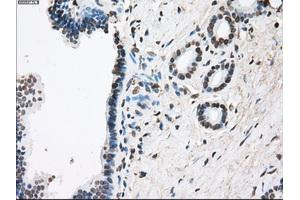 Immunohistochemical staining of paraffin-embedded Ovary tissue using anti-FCGR2A mouse monoclonal antibody. (FCGR2A Antikörper)