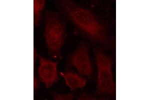 Immunofluorescence staining of methanol-fixed HeLa cells using Phospho-DOK2-Y299 antibody (ABIN2987731). (DOK2 Antikörper  (pTyr299))