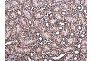 Immunohistochemistry (IHC) image for anti-NADH Dehydrogenase (Ubiquinone) Flavoprotein 1, 51kDa (NDUFV1) (Center) antibody (ABIN2855323)