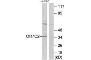 Western blot analysis of extracts from HuvEc cells, using OR7C2 Antibody. (OR7C2 Antikörper  (AA 198-247))