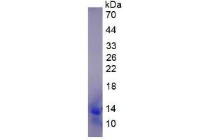 Image no. 2 for Chemokine (C-C Motif) Ligand 13 (CCL13) (AA 17-98) protein (His tag) (ABIN2121634) (CCL13 Protein (AA 17-98) (His tag))