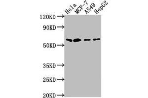 Western Blot Positive WB detected in: Hela whole cell lysate, MCF-7 whole cell lysate, A549 whole cell lysate, HepG2 whole cell lysate All lanes: SOX10 antibody at 1:2000 Secondary Goat polyclonal to rabbit IgG at 1/50000 dilution Predicted band size: 50, 32 kDa Observed band size: 60 kDa