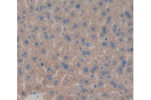 Used in DAB staining on fromalin fixed paraffin- embedded liver tissue (AGXT Antikörper  (AA 120-334))