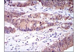 Immunohistochemistry (IHC) image for anti-Caspase 8 (CASP8) antibody (ABIN969003)