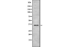 Western blot analysis of TAS2R9 using 293 whole cell lysates (TAS2R9 Antikörper)
