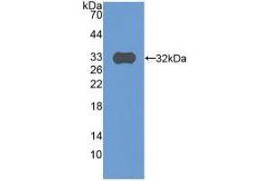 Western blot analysis of recombinant Human C9. (C9 Antikörper  (AA 22-265))
