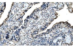 IHC analysis of DLX2 using anti-DLX2 antibody (ABIN7599936). (DLX2 Antikörper  (AA 13-310))