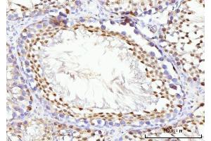 IHC analysis of KIFC1 using anti-KIFC1 antibody (ABIN7599523). (KIFC1 Antikörper  (AA 1-673))