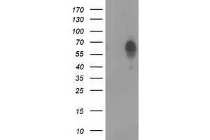 Western Blotting (WB) image for anti-Bestrophin 3 (BEST3) antibody (ABIN1501731)