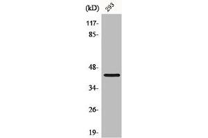 Western Blot analysis of HepG2 cells using CBX6 Polyclonal Antibody (CBX6 Antikörper  (N-Term))