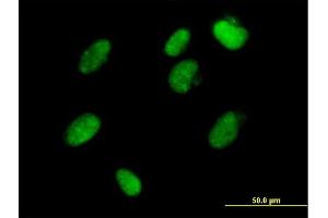Immunofluorescence of  purified  MaxPab antibody to ZFP1 on HeLa cell. (Zfp-1 Antikörper  (AA 1-352))