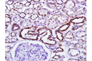 Immunohistochemistry (Paraffin-embedded Sections) (IHC (p)) image for anti-Eukaryotic Translation Initiation Factor 2-alpha Kinase 2 (EIF2AK2) (pThr446), (pThr451) antibody (ABIN744818)