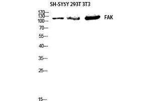 Western Blotting (WB) image for anti-PTK2 Protein tyrosine Kinase 2 (PTK2) (Thr444) antibody (ABIN6285158)