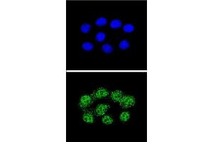 Confocal immunofluorescent analysis of MSH2 Antibody (Center) (ABIN655517 and ABIN2845032) with Hela cell followed by Alexa Fluor® 488-conjugated goat anti-rabbit lgG (green). (MSH2 Antikörper  (AA 637-665))