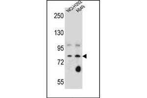 Western blot analysis of SCEL Antibody (Center) Cat. (SCEL Antikörper  (Middle Region))