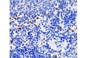 Immunohistochemistry of paraffin-embedded Mouse spleen using ANXA1 Polyclonal Antibody at dilution of 1:100 (40x lens). (Annexin a1 Antikörper)