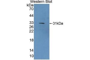 Detection of Recombinant COL9a1, Rat using Polyclonal Antibody to Collagen Type IX Alpha 1 (COL9a1) (COL9A1 Antikörper  (AA 24-268))