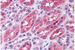 Human Kidney: Formalin-Fixed, Paraffin-Embedded (FFPE) (LMTK2 Antikörper  (AA 1181-1280))