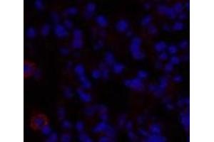 Immunofluorescence analysis of Rat lung tissue using TGFB1 Polyclonal Antibody at dilution of 1:200. (TGFB1 Antikörper)
