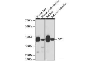Western blot analysis of extracts of various cell lines using OTC Polyclonal Antibody at dilution of 1:1000. (OTC Antikörper)