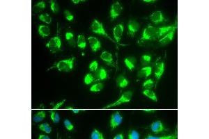 Immunofluorescence analysis of MCF-7 cells using SLC22A5 Polyclonal Antibody (SLC22A5 Antikörper)