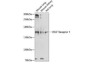 Western blot analysis of VEGFR1 expression using ABIN6140687