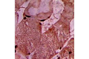 Immunohistochemical analysis of Vinculin staining in human heart formalin fixed paraffin embedded tissue section.