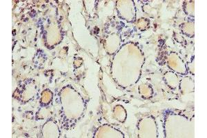 Immunohistochemistry of paraffin-embedded human thyroid tissue using ABIN7147338 at dilution of 1:100 (CRABP1 Antikörper  (AA 2-137))