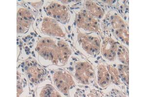 Used in DAB staining on fromalin fixed paraffin- embedded stomach tissue (ABCF1 Antikörper  (AA 625-845))