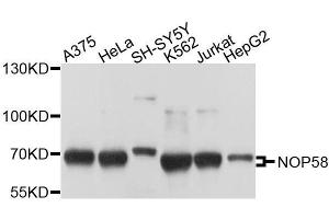 Western blot analysis of extracts of various cell lines, using NOP58 antibody. (NOP58 Antikörper  (AA 360-529))