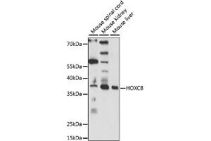 Western blot analysis of extracts of various cell lines, using HOXC8 antibody (ABIN7267773) at 1:1000 dilution. (HOXC8 Antikörper  (AA 1-150))
