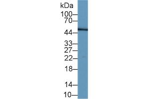 Detection of LRG1 in Human Serum using Monoclonal Antibody to Leucine Rich Alpha-2-Glycoprotein 1 (LRG1) (LRG1 Antikörper  (AA 37-340))